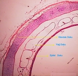 Kıkırdak Çeşitleri Nelerdir?