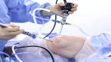 Diz Kıkırdak Nakli Diz Kıkırdak Nakli